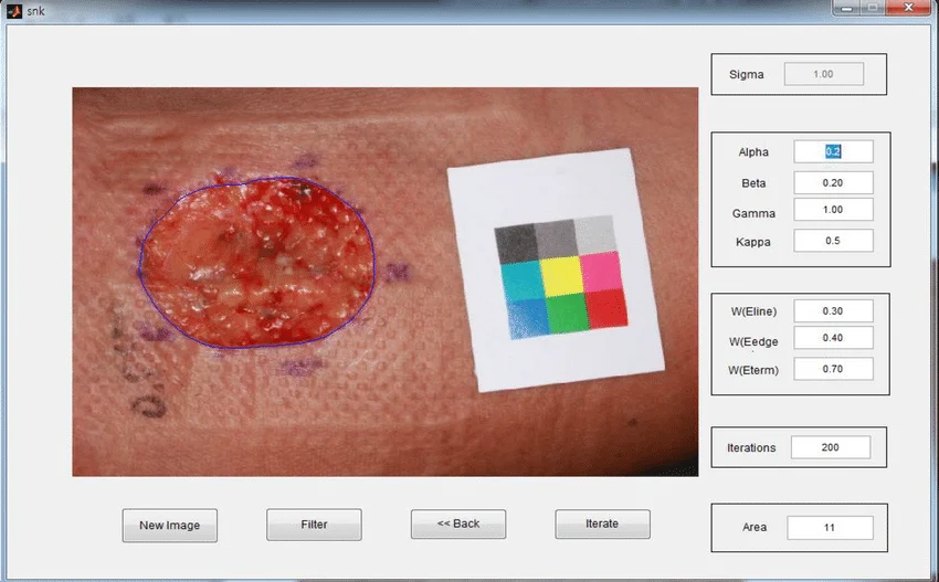 Mapping Unseen Wounds