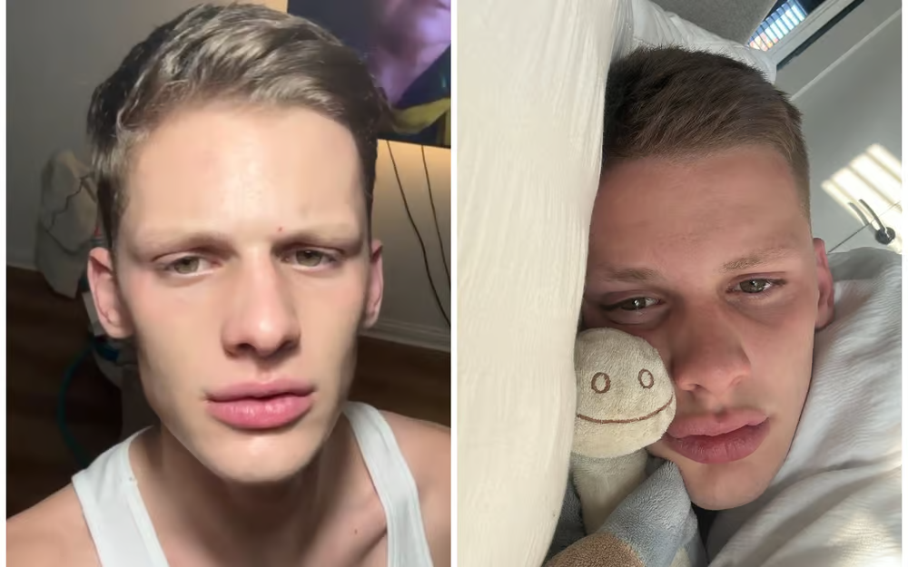 freddy brazier